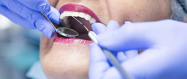 Best Emergency Treatment for Dental Infections or Abscesses in Lone Pine, CA